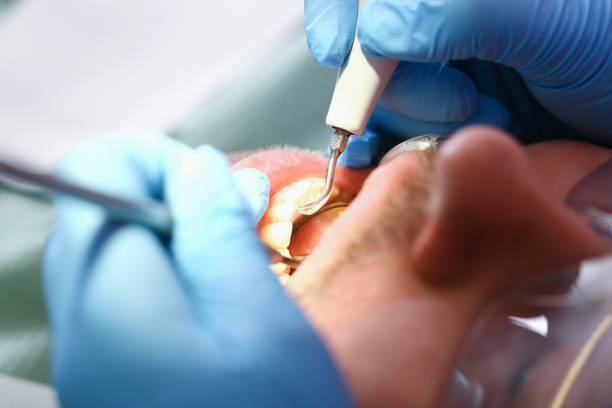 Best Mobile Emergency Dentist in Barberton, OH