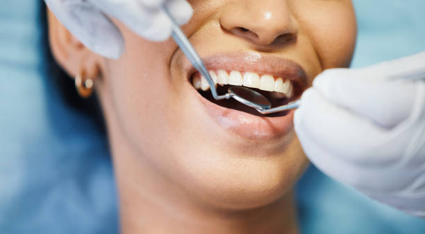 Best Emergency Root Canal Treatment in Barberton, OH