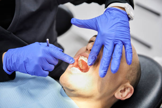 Best Emergency Dentist for Lost Fillings or Crowns in Barberton, OH
